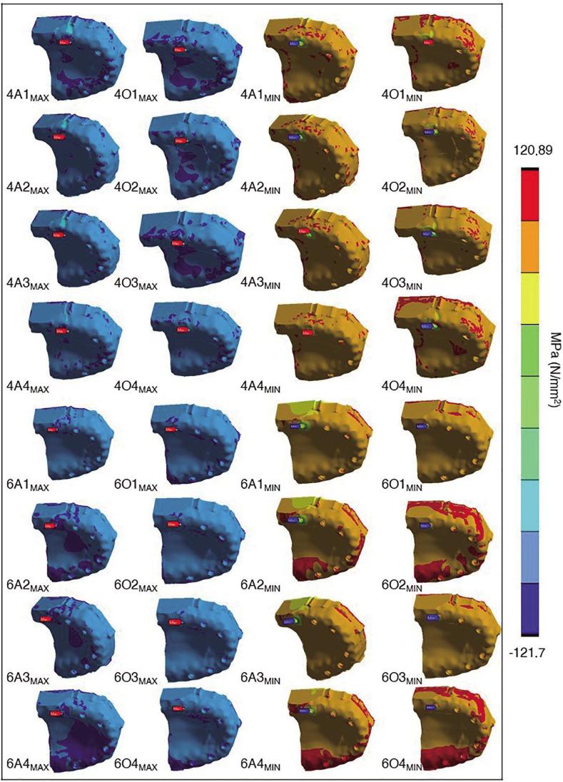https://cdn.ncbi.nlm.nih.gov/pmc/blobs/e432/9832146/498b4e2a90b8/jap-14-346-g004.jpg