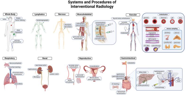 https://cdn.ncbi.nlm.nih.gov/pmc/blobs/e437/11288872/da0abd4626ca/fradi-04-1403761-g001.jpg