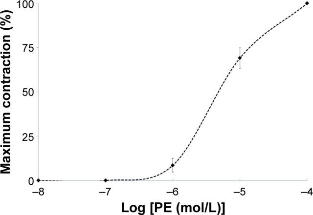 https://cdn.ncbi.nlm.nih.gov/pmc/blobs/e438/4869645/7e402d214db2/opth-10-845Fig3.jpg