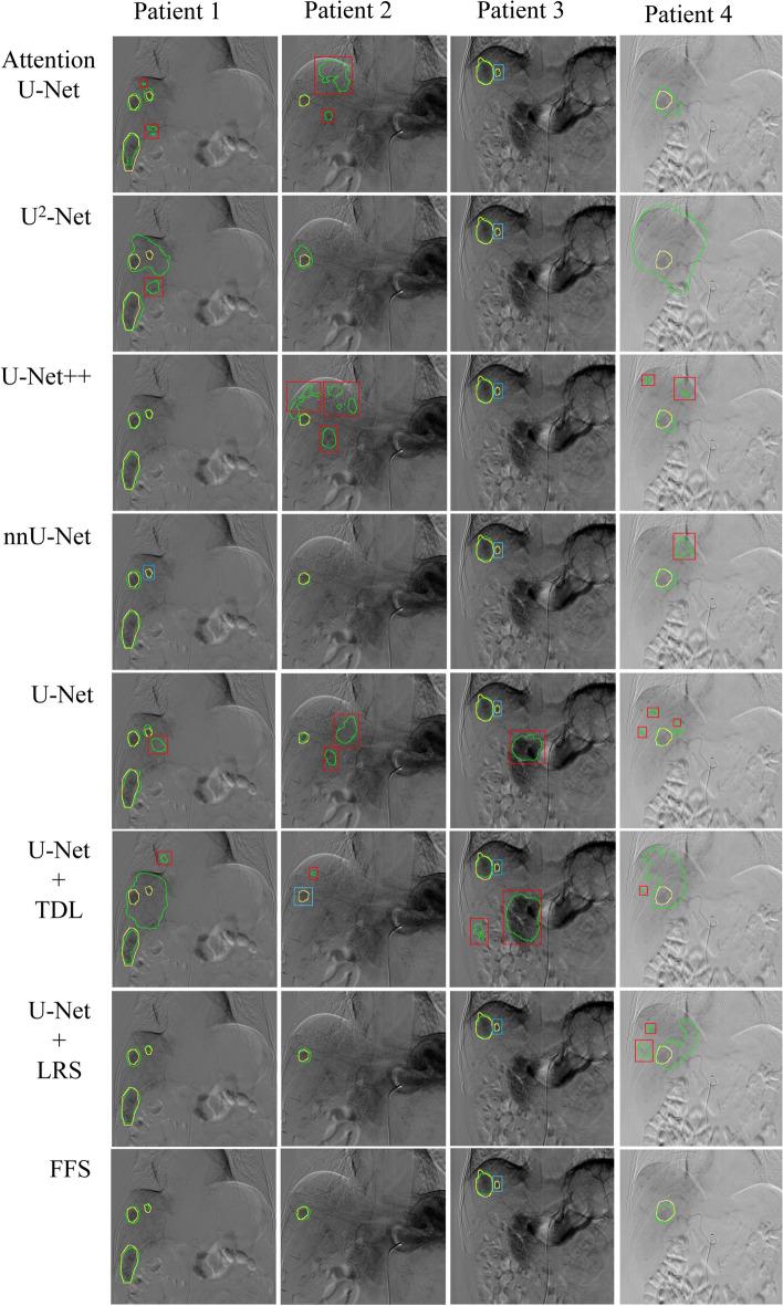 https://cdn.ncbi.nlm.nih.gov/pmc/blobs/e43e/9101835/9219d6bfb156/40644_2022_457_Fig3_HTML.jpg