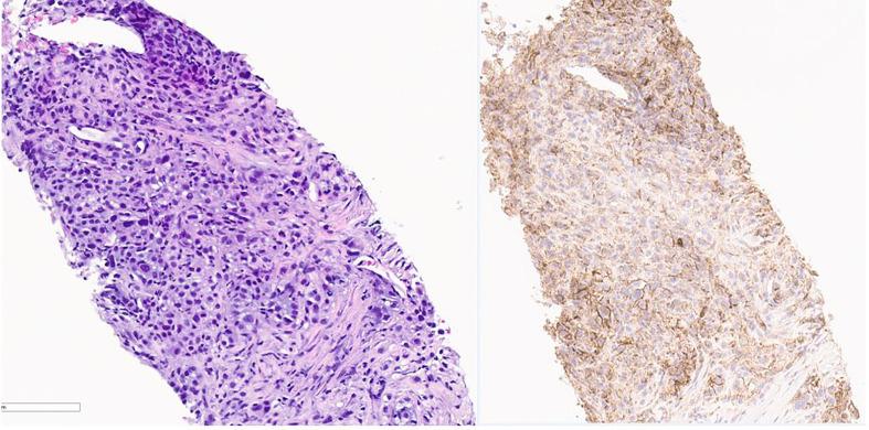 https://cdn.ncbi.nlm.nih.gov/pmc/blobs/e441/9019553/9f0d0970e3cf/fonc-12-856944-g003.jpg