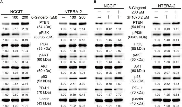 https://cdn.ncbi.nlm.nih.gov/pmc/blobs/e442/8595921/cd530e36947e/fonc-11-781720-g004.jpg