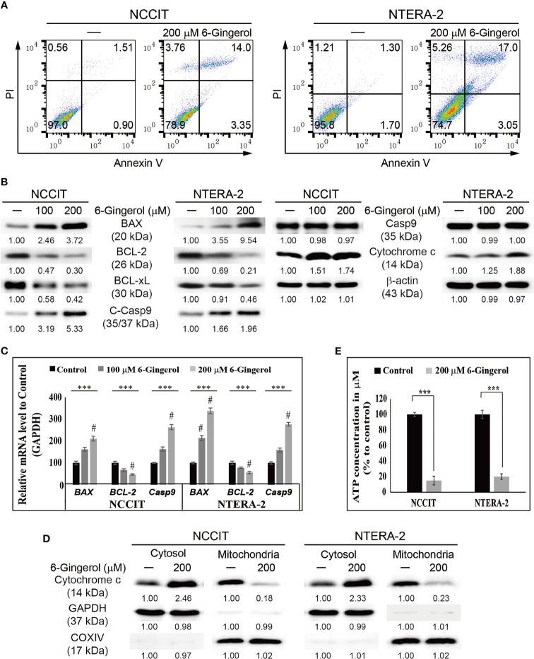 https://cdn.ncbi.nlm.nih.gov/pmc/blobs/e442/8595921/ee49efe897eb/fonc-11-781720-g003.jpg