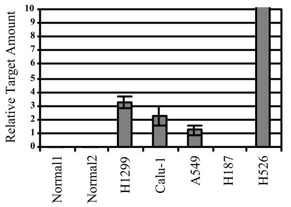 https://cdn.ncbi.nlm.nih.gov/pmc/blobs/e445/1501041/50040d6db100/1471-2407-6-151-7.jpg