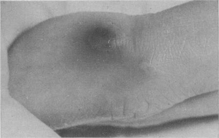 https://cdn.ncbi.nlm.nih.gov/pmc/blobs/e44b/1700401/412151bfe224/brmedj02286-0040-c.jpg