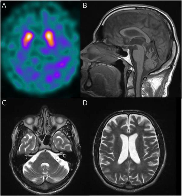 https://cdn.ncbi.nlm.nih.gov/pmc/blobs/e44c/12135070/02ec9fe103ac/NXG-2024-100301f1.jpg