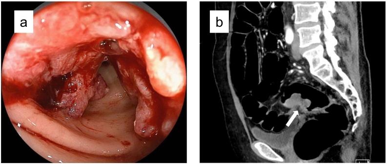 https://cdn.ncbi.nlm.nih.gov/pmc/blobs/e44c/8318923/24d62c55b39e/gr1.jpg