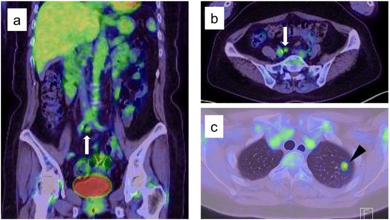 https://cdn.ncbi.nlm.nih.gov/pmc/blobs/e44c/8318923/7cdc00e7ef8d/gr3.jpg