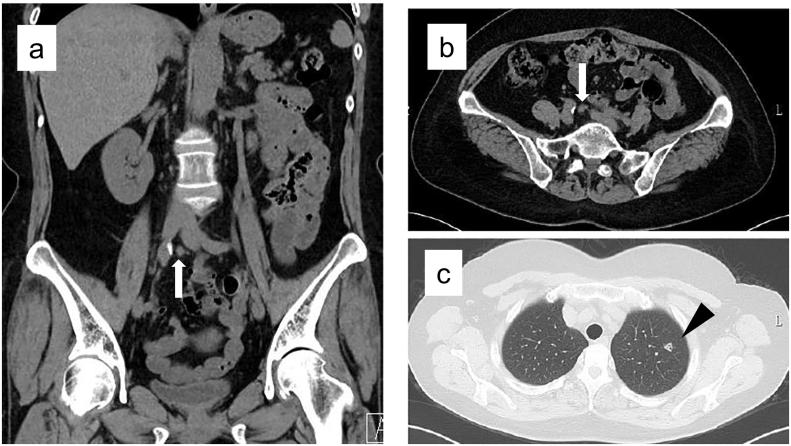 https://cdn.ncbi.nlm.nih.gov/pmc/blobs/e44c/8318923/e6dcbcbd25cd/gr2.jpg