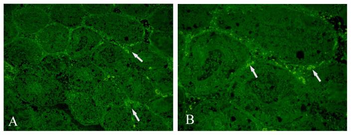 https://cdn.ncbi.nlm.nih.gov/pmc/blobs/e459/10381221/0548ac3177f5/turkjmedsci-52-2-505f4.jpg