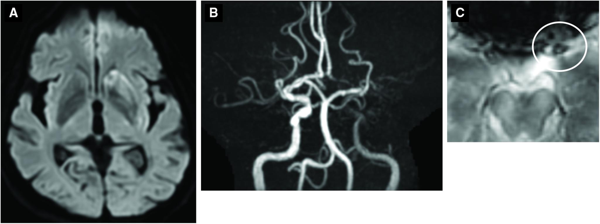 https://cdn.ncbi.nlm.nih.gov/pmc/blobs/e45a/10370615/d605756c3841/jnet-15-38-g002.jpg