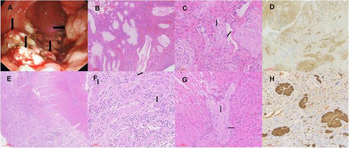 https://cdn.ncbi.nlm.nih.gov/pmc/blobs/e460/9243541/58bc8e51a847/fmed-09-883958-g001.jpg