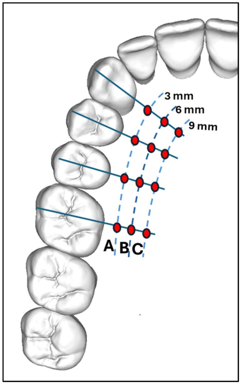 https://cdn.ncbi.nlm.nih.gov/pmc/blobs/e467/12293691/b41f6babe380/dentistry-13-00283-g001.jpg