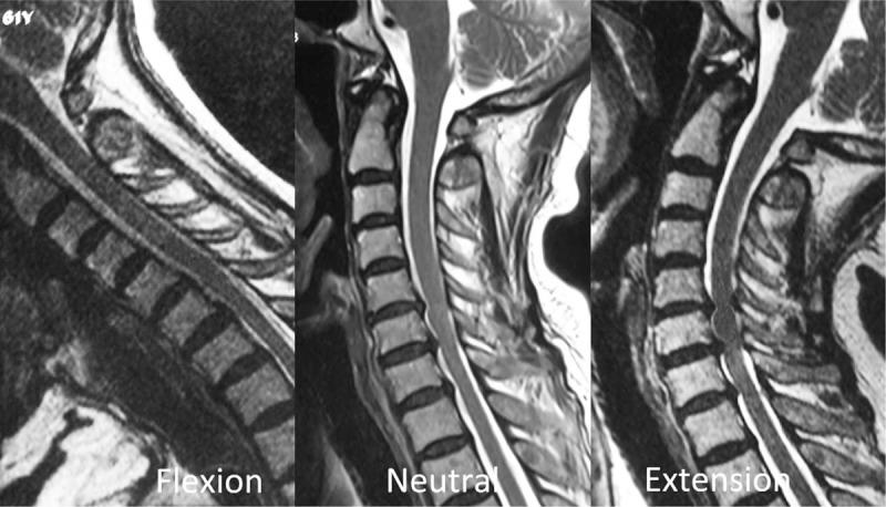 https://cdn.ncbi.nlm.nih.gov/pmc/blobs/e46a/5627847/334d1f65ede8/medi-96-e7623-g001.jpg
