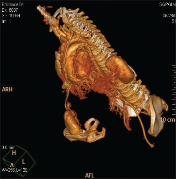 https://cdn.ncbi.nlm.nih.gov/pmc/blobs/e46b/2938558/8efad6bddf5c/IJU-26-289-g001.jpg