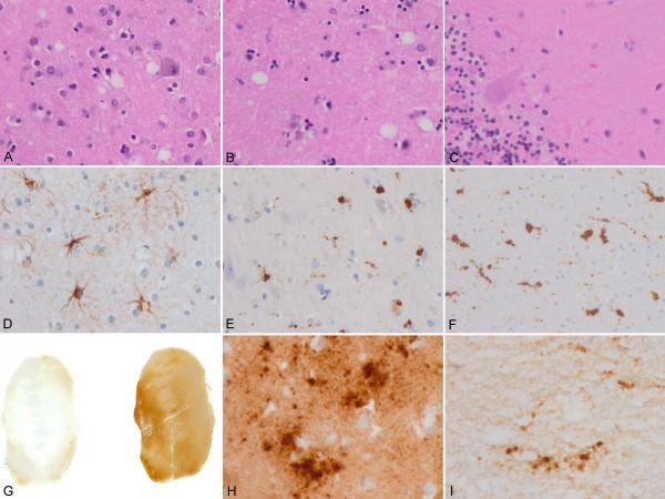 https://cdn.ncbi.nlm.nih.gov/pmc/blobs/e472/2987858/03d57eb342a4/1471-2377-10-99-1.jpg
