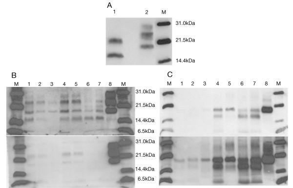 https://cdn.ncbi.nlm.nih.gov/pmc/blobs/e472/2987858/d459fbb4fc8f/1471-2377-10-99-5.jpg