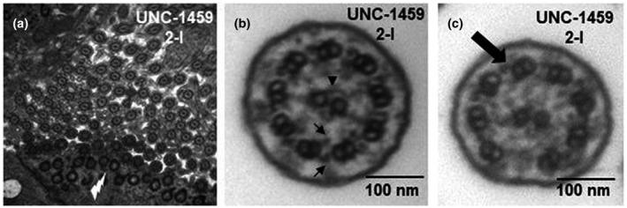 https://cdn.ncbi.nlm.nih.gov/pmc/blobs/e473/8372090/ace613ef16d7/MGG3-9-e1726-g001.jpg