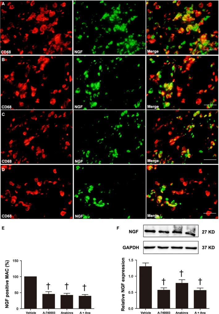 https://cdn.ncbi.nlm.nih.gov/pmc/blobs/e476/5661108/3709857af438/JCMM-21-2695-g005.jpg