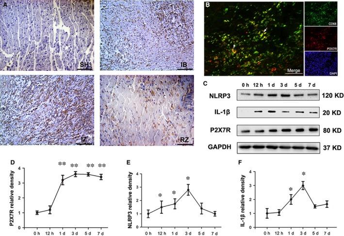 https://cdn.ncbi.nlm.nih.gov/pmc/blobs/e476/5661108/a3184d515804/JCMM-21-2695-g001.jpg