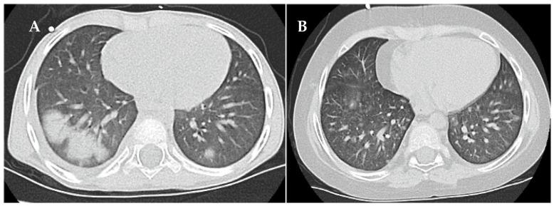 https://cdn.ncbi.nlm.nih.gov/pmc/blobs/e477/11477708/8c174728f6a2/jcm-13-05995-g003.jpg