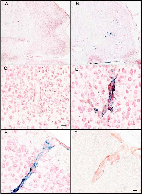 https://cdn.ncbi.nlm.nih.gov/pmc/blobs/e479/539292/3e19746482b3/1742-2094-1-24-4.jpg