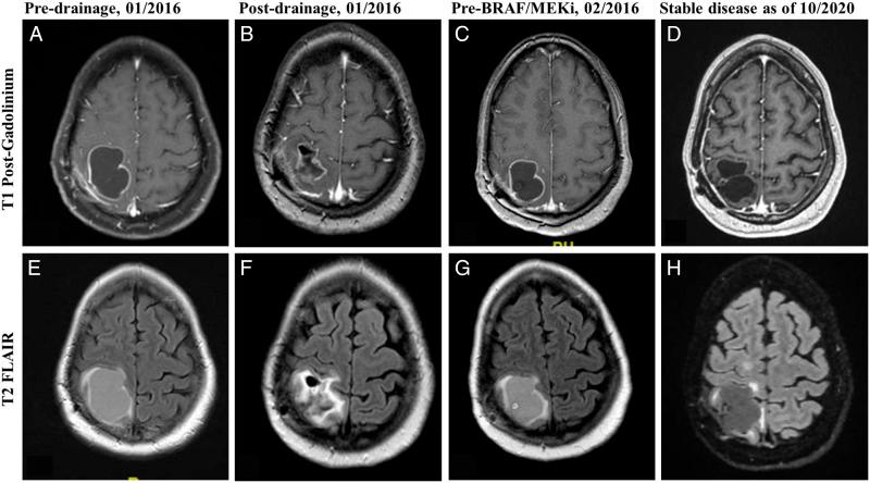 https://cdn.ncbi.nlm.nih.gov/pmc/blobs/e479/8506147/463ed52dd485/10.1177_10732748211040013-fig3.jpg