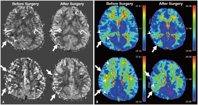 https://cdn.ncbi.nlm.nih.gov/pmc/blobs/e47e/8390823/7e46c818dfb0/kjr-22-1537-g004.jpg