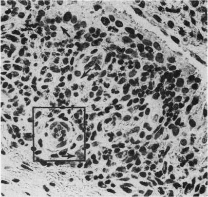 https://cdn.ncbi.nlm.nih.gov/pmc/blobs/e483/1001266/38c077a93b19/annrheumd00246-0129-a.jpg