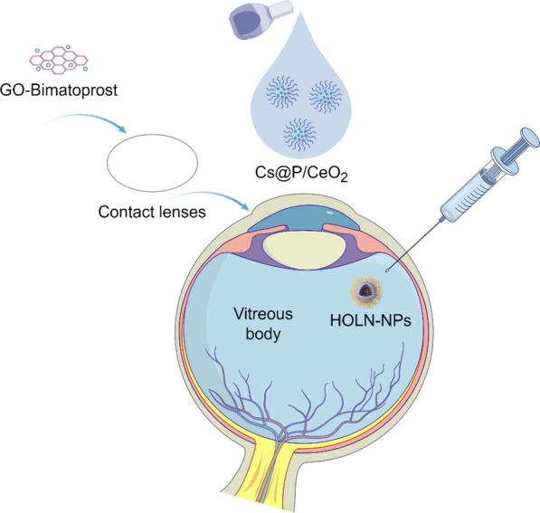 https://cdn.ncbi.nlm.nih.gov/pmc/blobs/e490/12123787/387810239b92/12951_2025_3442_Fig20_HTML.jpg
