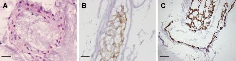 https://cdn.ncbi.nlm.nih.gov/pmc/blobs/e490/2989195/3bec851a13ce/586_2010_1378_Fig1_HTML.jpg