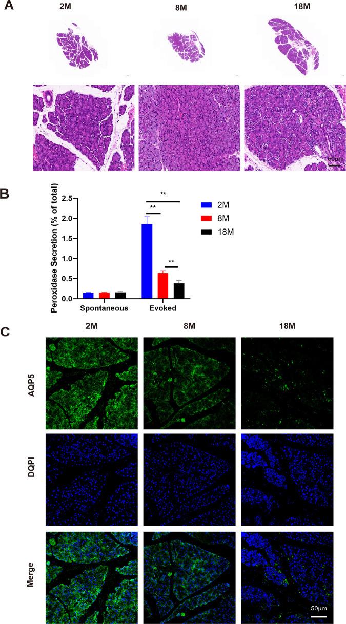 https://cdn.ncbi.nlm.nih.gov/pmc/blobs/e491/11844230/4b0a6217ffcb/iovs-66-2-51-f001.jpg