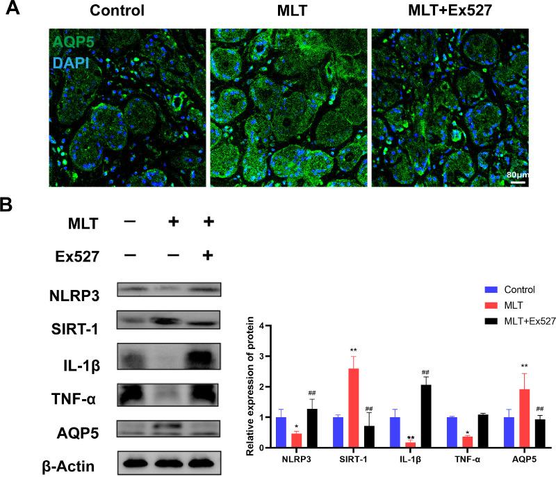 https://cdn.ncbi.nlm.nih.gov/pmc/blobs/e491/11844230/75c9d576fdfa/iovs-66-2-51-f008.jpg