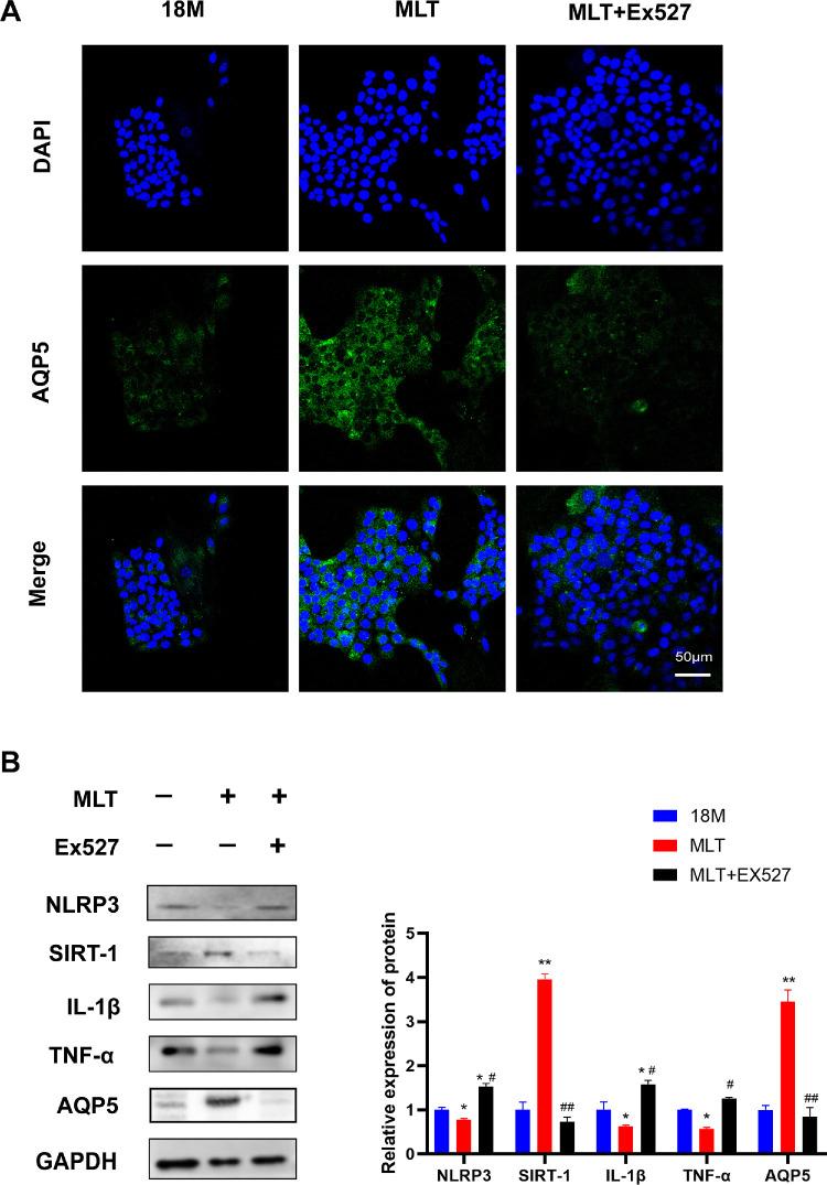 https://cdn.ncbi.nlm.nih.gov/pmc/blobs/e491/11844230/7df86c1dd67e/iovs-66-2-51-f006.jpg