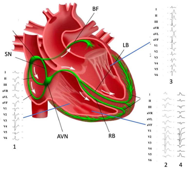 https://cdn.ncbi.nlm.nih.gov/pmc/blobs/e495/10141128/f8b1821d9a9d/jcdd-10-00159-g001.jpg