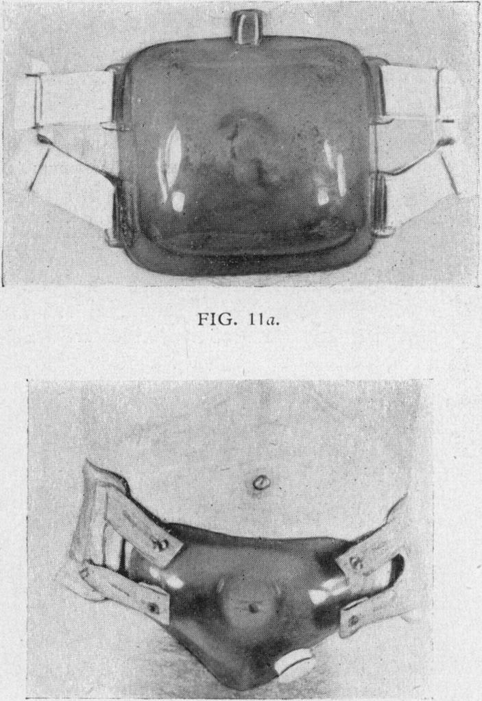 https://cdn.ncbi.nlm.nih.gov/pmc/blobs/e4a0/2181360/2548a54f401e/procrsmed00559-0058-b.jpg