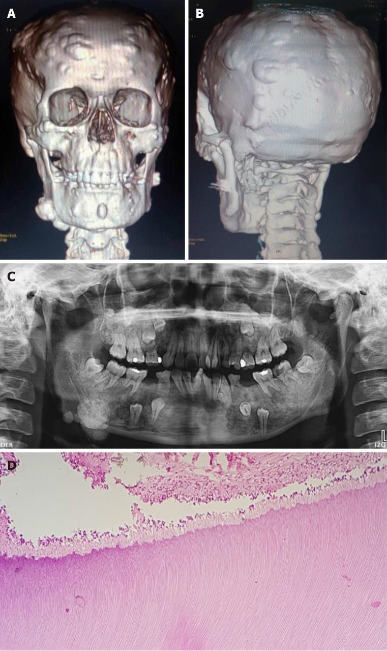 https://cdn.ncbi.nlm.nih.gov/pmc/blobs/e4aa/11551705/d393aad905c8/98005-g001.jpg