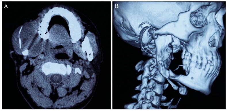 https://cdn.ncbi.nlm.nih.gov/pmc/blobs/e4b4/10673442/5bba5dcf3bf3/medicina-59-01956-g001.jpg