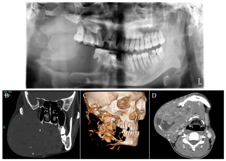 https://cdn.ncbi.nlm.nih.gov/pmc/blobs/e4b4/10673442/65bf29e2497a/medicina-59-01956-g003.jpg