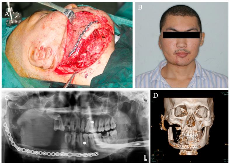 https://cdn.ncbi.nlm.nih.gov/pmc/blobs/e4b4/10673442/93d5d35a86b4/medicina-59-01956-g008.jpg