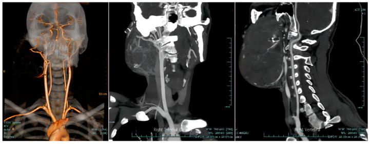 https://cdn.ncbi.nlm.nih.gov/pmc/blobs/e4b4/10673442/9c7a83524ea1/medicina-59-01956-g005.jpg