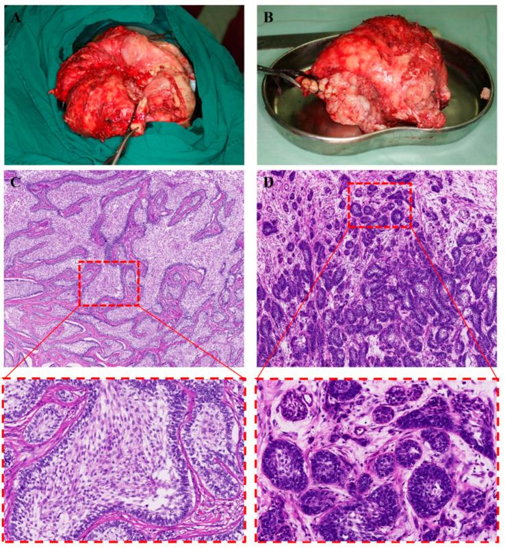 https://cdn.ncbi.nlm.nih.gov/pmc/blobs/e4b4/10673442/bbbb10e645ac/medicina-59-01956-g006.jpg