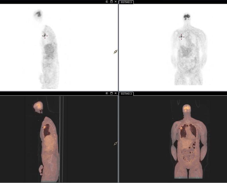 https://cdn.ncbi.nlm.nih.gov/pmc/blobs/e4b6/8230943/4c15ed01d307/bcr-2020-241067f02.jpg