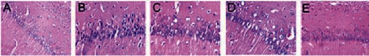 https://cdn.ncbi.nlm.nih.gov/pmc/blobs/e4bf/9444384/90462e25c398/ECAM2022-8980627.006.jpg