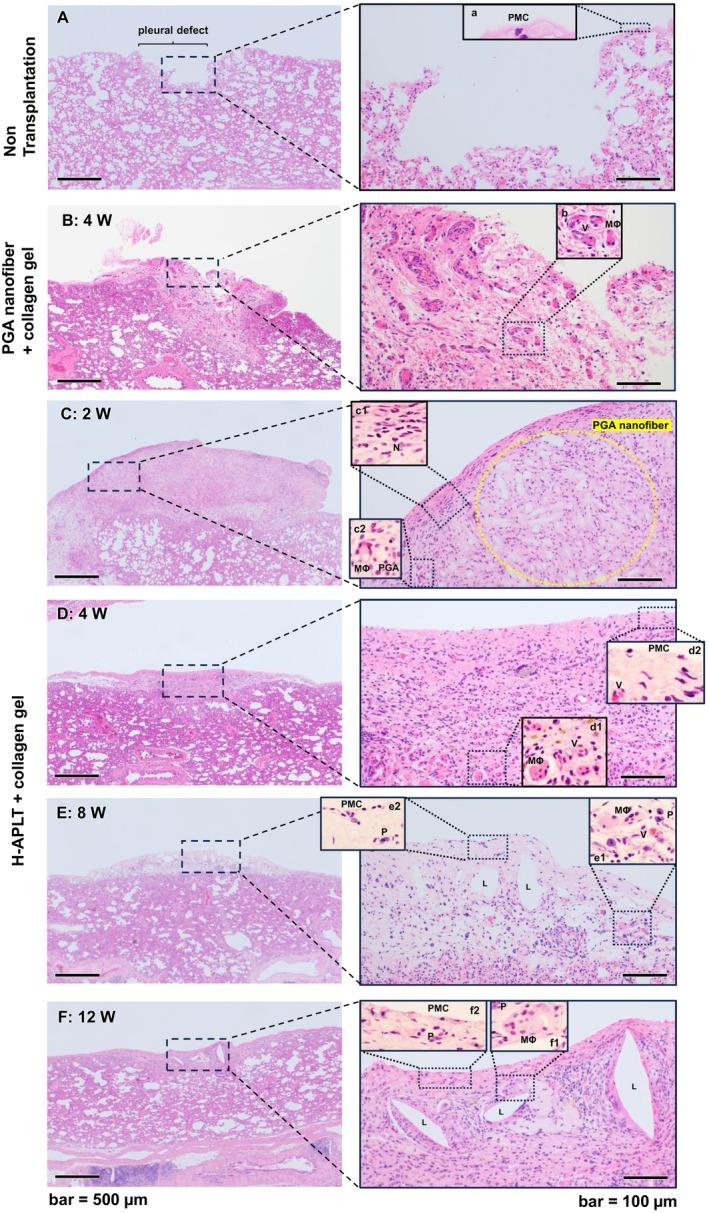 https://cdn.ncbi.nlm.nih.gov/pmc/blobs/e4c2/12019103/f0e95c67a4aa/AOR-49-778-g009.jpg
