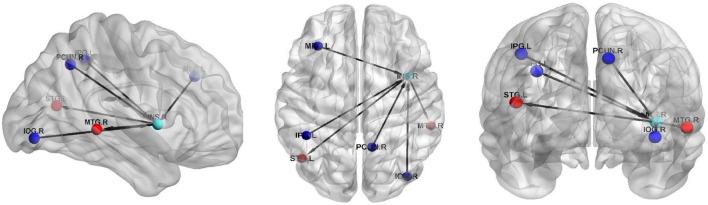 https://cdn.ncbi.nlm.nih.gov/pmc/blobs/e4c3/10783996/1cf6c4c39bc3/qims-14-01-305-f5.jpg