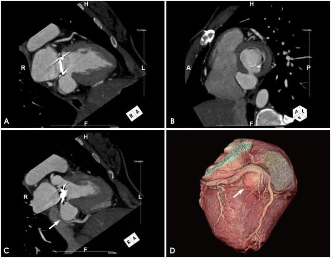 https://cdn.ncbi.nlm.nih.gov/pmc/blobs/e4c7/3021897/283093d0f0f9/jcu-18-157-g002.jpg