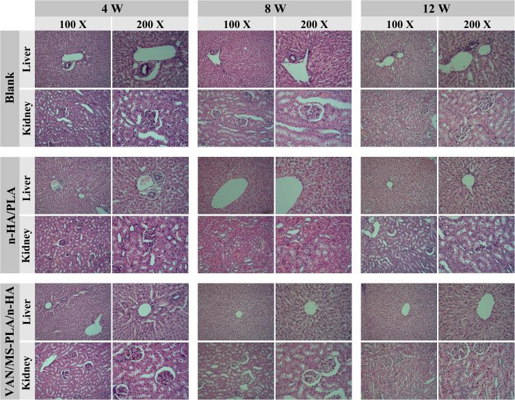 https://cdn.ncbi.nlm.nih.gov/pmc/blobs/e4c7/9868285/a2f7cd74095a/IJN-18-307-g0009.jpg