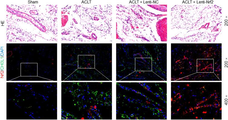 https://cdn.ncbi.nlm.nih.gov/pmc/blobs/e4c9/8403022/0ba9529b1052/JIR-14-4079-g0003.jpg