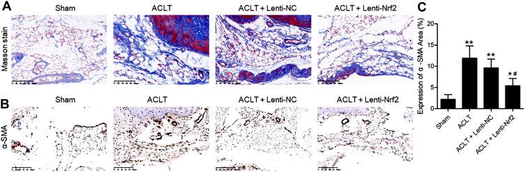 https://cdn.ncbi.nlm.nih.gov/pmc/blobs/e4c9/8403022/b906645406e0/JIR-14-4079-g0002.jpg